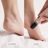 PediPen – Râpe électrique pieds pour talons doux | Roselie